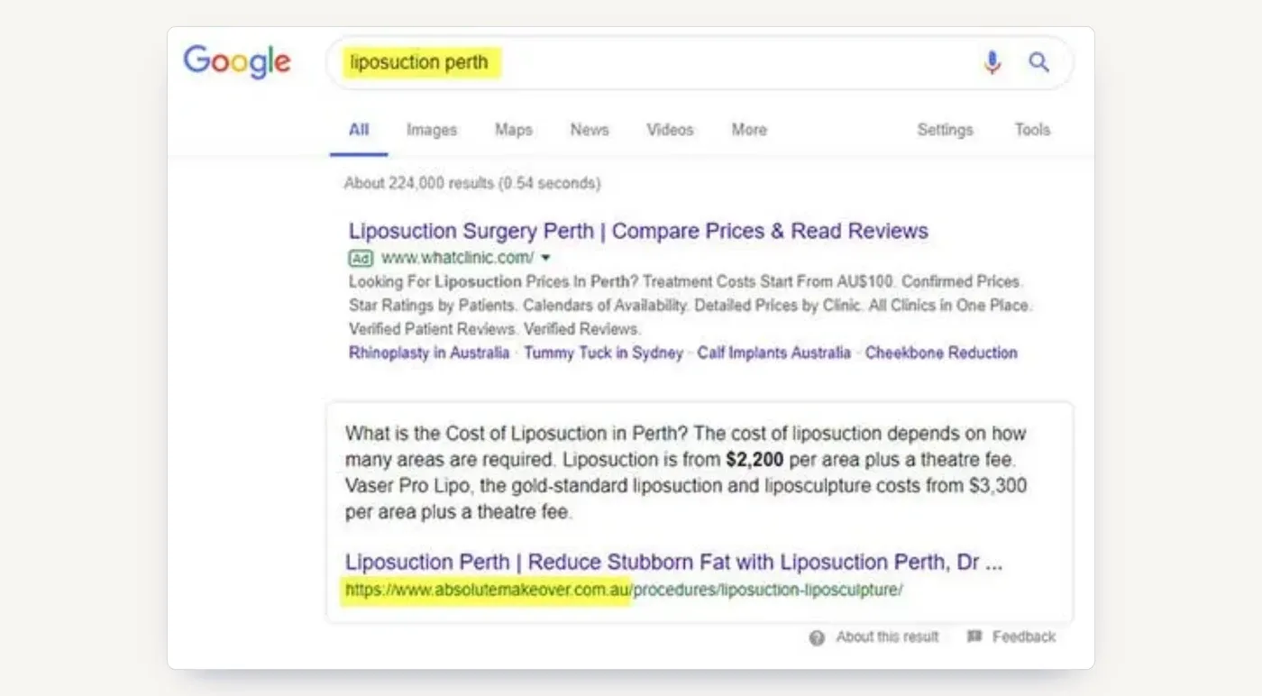 Liposuction Perth: Absolute Cosmetic holding the featured snippet above the organic results, position 0.